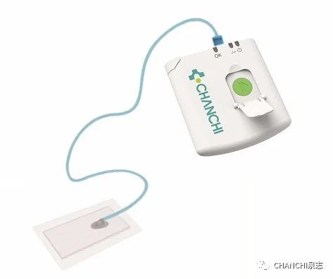 Intelligent Micro-negative Pressure Wound Treatment